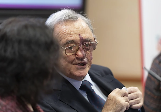 İspanya'nın pankreas kanseri araştırmalarında atılımı desteklemek için başlatılan bağış kampanyası