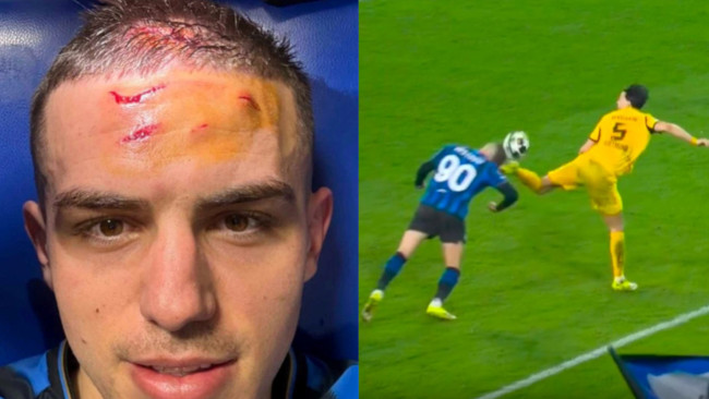 Atalanta'dan Nikola Krstović, BVB'ye karşı dramatik son dakika penaltısının ardından alnını gösteriyor