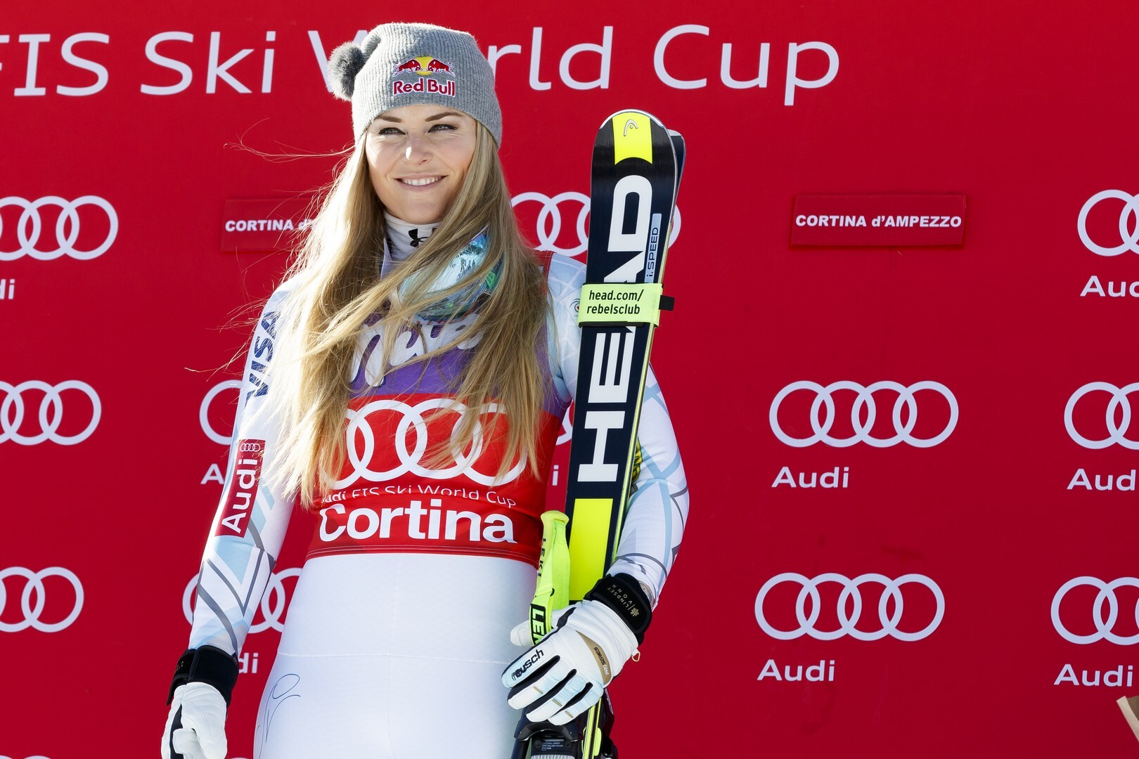 Cortina'da düşüşten sonra Lindsey Vonn için ilk sağlık güncellemesi: "stabil durumda ve iyi ellerde"