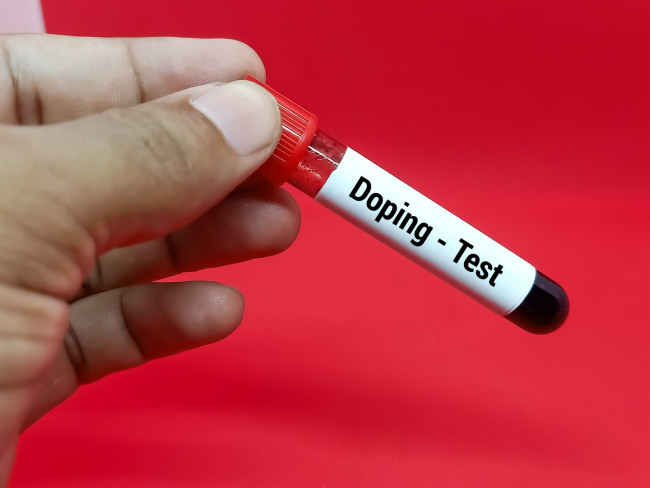 Tour de France anti-doping testleri, sürücüler arasında şikayetlere ve bazı hileli suçlamalara yol açtı