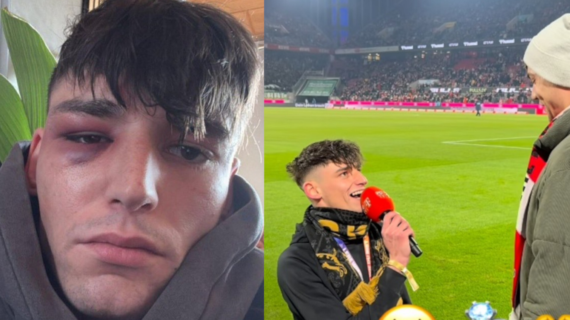 Alman futbol hakemi, nişanlısına kamuoyuna evlenme teklif ettikten birkaç gün sonra homofobik saldırıya uğradı