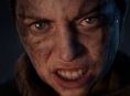 Senua's Saga: Hellblade II nihayet fiziksel bir sürüm alıyor gibi görünüyor