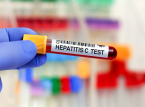 İngiltere, hepatit C'yi ortadan kaldıran ilk &uuml;lkelerden biri olma yolunda